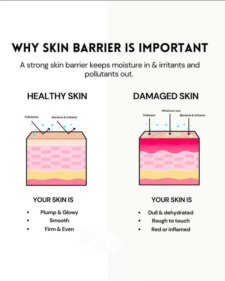 Barrier Repair & Lipids