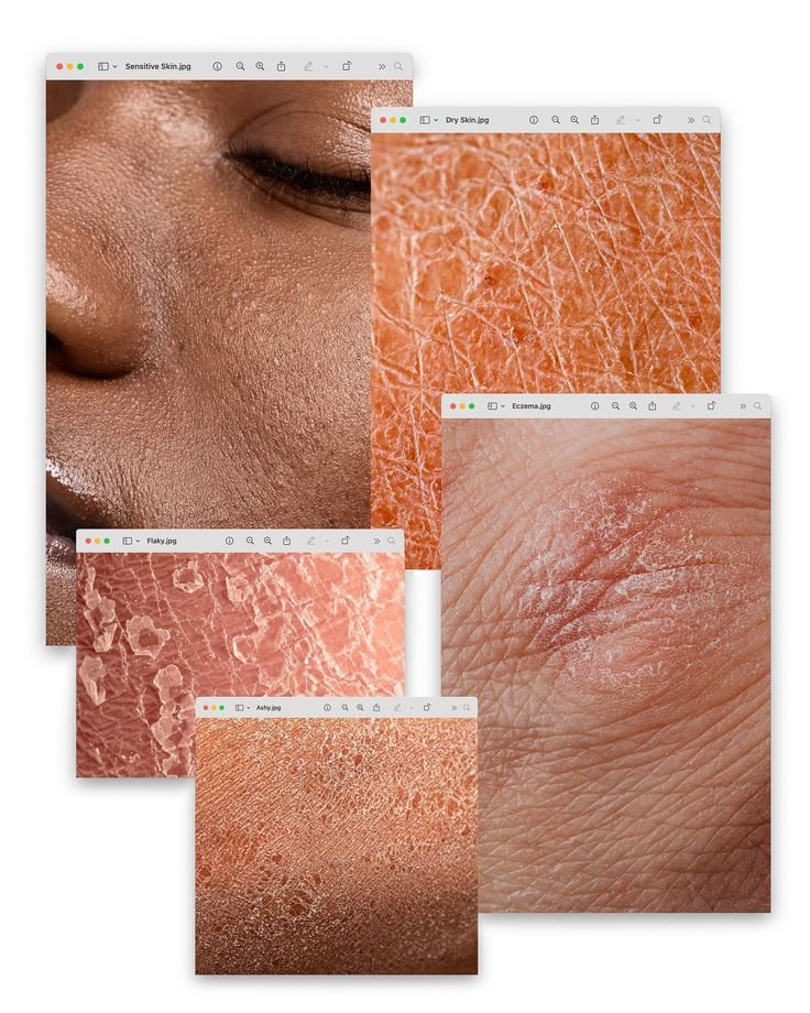 Barrier Repair & Lipids