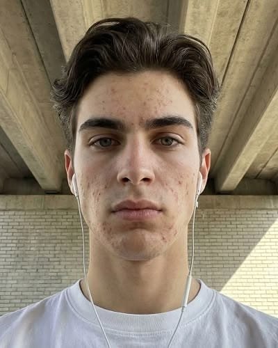 Men's Acne & Pore Control