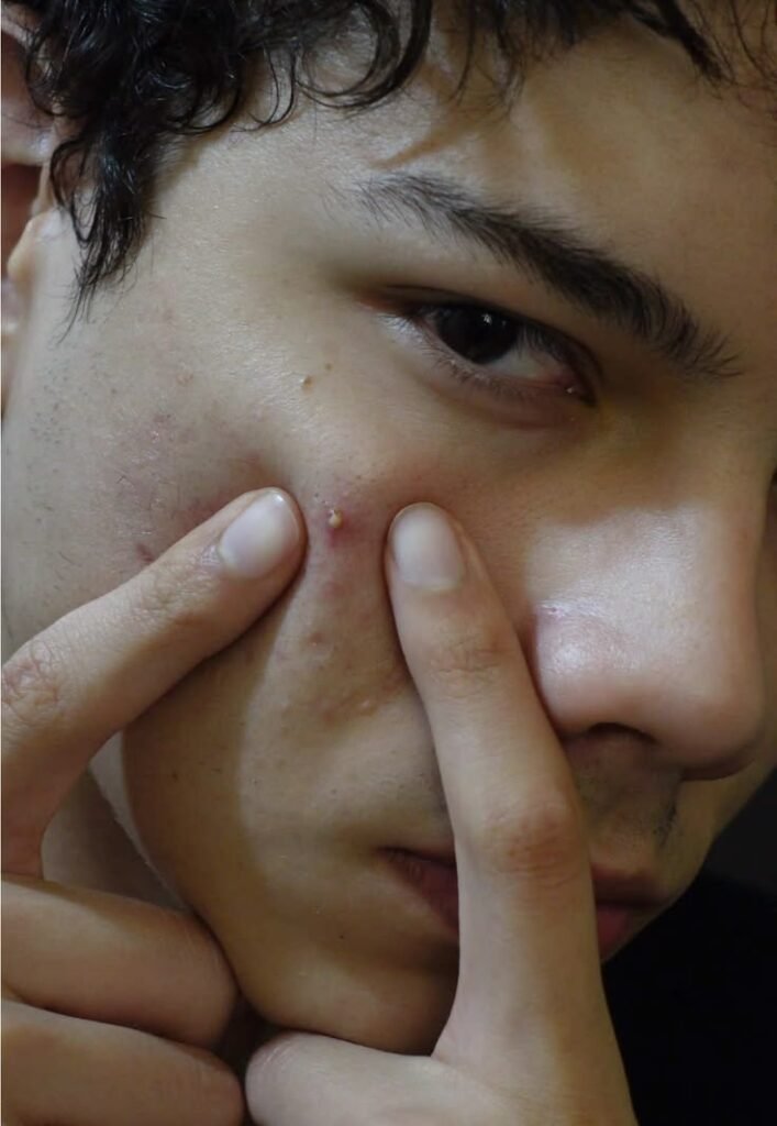 Men's Acne & Pore Control