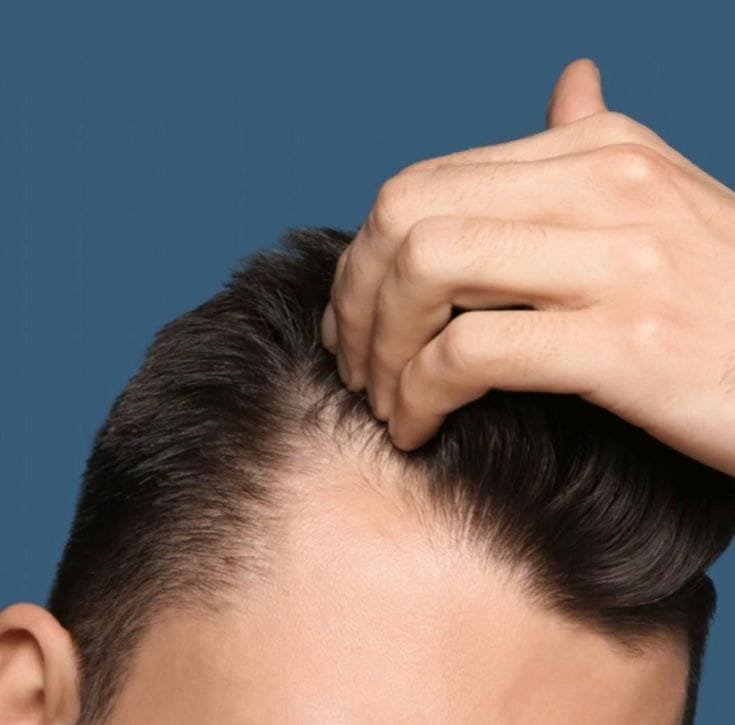 Scalp Care for Men